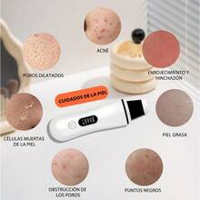 TendenciaLimpieza Profunda Facial Ultrasónica Portátil ProfesionalCalidad premium - Blanco - Ver 4