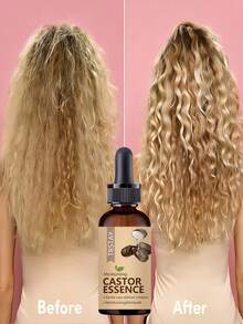 Hydrating Scalp Treatment Essential Oil for Hair Loss Prevention and Growth Stimulation Improves Blood Circulation Restores Thickness Nourishes Scalp Strengthens Hair Follicles Promotes Healthy Hair - Ropa formal - Ver 2