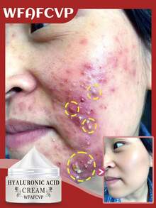 这款富含胶原蛋白的面霜旨在紧致肌肤并提供深层补水，适合所有肤质。这款保湿霜含有肽，是理想的护肤之选。 - 彩色 - 查看 7