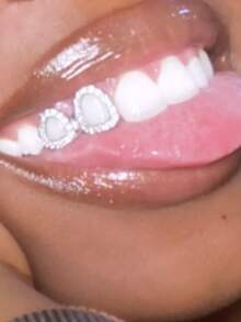 1 Set Hollow Heart & Arch Zirconia Hollow Shiny Cute Hip Hop Tooth Jewelry, Suitable For Valentine's Day Gift, Unisex - Multicolor - View 2