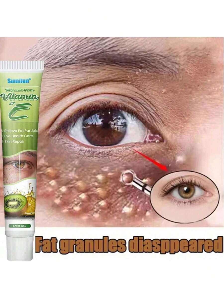 Fat Granules Remover Eye Cream Effective Remove Fat Granules Puffiness Anti-Particles Milia Remover Product Repair Eye Skin Care - 1件 - 查看 1