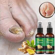 2-Pack Ginger Nail Care Spray, Multi-Functional Foot Care Liquid, Specially Designed For Discolored And Thickened Nails, Suitable For Both Hands And Feet, Nourishes And Protects The Nail Surface, Maintains Good Condition, Gentle And  Formula Suitable For All Skin Types, Easy To Use. RBPQ - 2 - Xem 2
