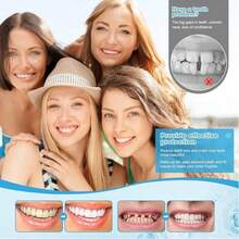 Veneers Teeth For Women And Men, Temporary Tooth Replacement Kit, Nature And Comfortable - White - View 2
