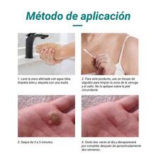 30ml/60ml de acción rápida para eliminar verrugas, con ácido salicílico, apto para todas las partes del cuerpo, para verrugas planas, verrugas comunes,duofilm verrugas,verrugas plantares y callos, fórmula suave, imprescindible para familiares y amigos, vale la pena usarlo de forma continua y es un gran regalo - Masaje de cuello - Ver 7