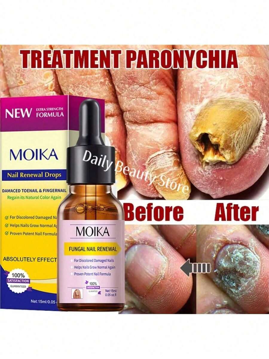 Let You Have Healthy Nails