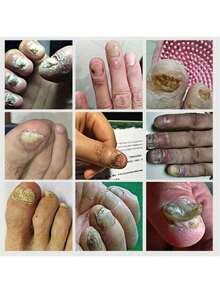 Let You Have Healthy Nails - 1 Item - View 4