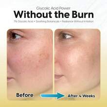 7% Glycolic Acid Exfoliating Toner–Gentle Brightening Formula For Face & Body–Minimizes Pores, Improves Texture & Fine Lines –With Triple Ceramides, Aha & Licorice–All Skin Types - 預設 - 查看 6