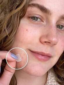 720pcs Transparent Acne Pimple Patch, Hydrocolloid Comfortable Breathable, Strong Adhesive