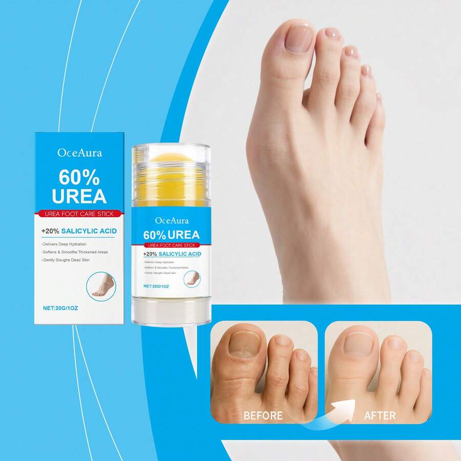 OceAura 60% Urea Foot Cream Stick - Deep Penetrates Moisturizing Gentle ...