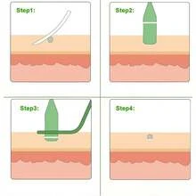 Gentle Skin Maintenance Adults And Teens Daily Cleansing Brush With Soft Silicone Bristles Deep Pore Cleansing Acne Care And Exfoliation Rechargeable Waterproof Face Cleanser - S - 查看 6