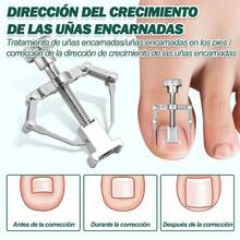 TendenciaJuego Cortaúñas Y Cortacutículas Para Manos Y Pies Verde OscuroCalidad premium - Verde oscuro - Ver 8