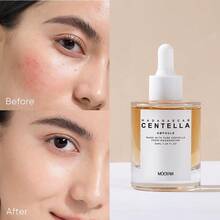 MOOYAM 50毫升积雪草精华，蕴含积雪草和玻尿酸，具有美白、提亮、保湿、淡斑、舒缓和修护功效。是旅行、新年和情人节的理想礼物，也是敏感肌肤的必备精华。 - Centella asiatica - 查看 11