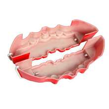 4X 3D Style Brake Caliper Covers Universal Car Disc Front & Rear Kits Red UK New - A - View 7