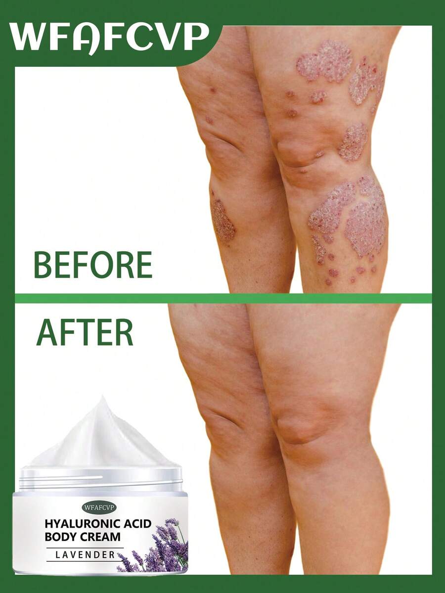 Collagen Boosting Firming Moisturizing Body Lotion - Fragrance-Free, Infused With Oud Oil, Coconut Oil And Vitamin E, Suitable For All Skin Types - Multicolor - View 1