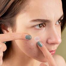 720 parches para el acné de 0,1 mm ultra delgados, adhesivos, impermeables, antideslizantes de hidrocolloid, cómodos y transpirables - Multicolor - Ver 6