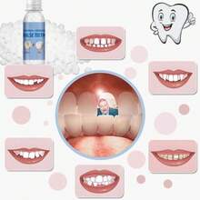 Tooth Repair  For Filling The Missing Broken Tooth And Gaps-Moldable Fake Teeth And Thermal Beads Replacement IQLA - 白色 - 查看 1