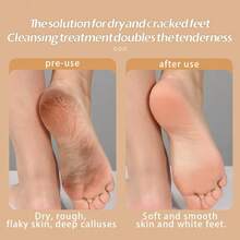 Electric Foot Grinder, Dead Skin Remover, Foot Scrubber, Callus Remover, Dry Cracked Feet Care And Repair - Multicolor - View 3