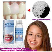 Tooth Repair  For Filling The Missing Broken Tooth And Gaps-Moldable Fake Teeth And Thermal Beads Replacement IQLA - 白色 - 查看 2