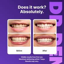 DRDENT Purple Teeth Whitening Strips -/21 Whitening Sessions - Enamel - Non Sensitive Teeth Whitening - Peroxide- - 42 dải (21 buổi) - Xem 3