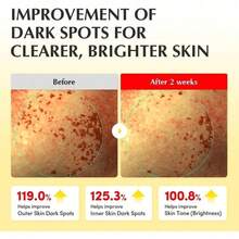 Vitamin Illuminating Toner - Brightening Vitamin C & Niacinamide 3% | Gentle Daily Exfoliating | Skin-Prep Hydration For Glowy Skin | Holiday Gifts (5.07 Fl.Oz / 150ml) - 預設 - 查看 4