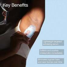 Topicals High Roller Hair Protection Serum | Rollerball Treatment Soothes And Calms Damaged Skin On The Face, Underarms And Bikini Area | Contains Salicylic Acid And Glycolic Acid | Vegan Formula And Non-Irritating (1.7 Fl Oz) - Multicolor - 查看 3