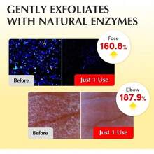 Vitamin Illuminating Toner - Brightening Vitamin C & Niacinamide 3% | Gentle Daily Exfoliating | Skin-Prep Hydration For Glowy Skin | Holiday Gifts (5.07 Fl.Oz / 150ml) - 預設 - 查看 5