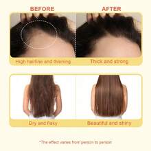 Nattshare 这款生姜护发精油蕴含生姜根提取物，能够强韧发丝，尤其适合干枯受损发质。这款滋养护发精油能够从发根到发梢深层滋养秀发，减少毛躁，提升柔顺度，并修复热损伤。 - 綠色 - 查看 7