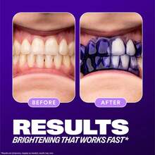 His*Ile V34 Colour Corrector - Tooth Stain Concealer, Teeth Brightening Booster, Purple Toothpaste, Colour Correcting, His*Ile V34 - 1 - 查看 5