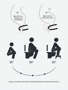 1个马桶脚凳，PP材质，加厚脚踏凳，蹲便辅助凳，马桶座圈，折叠凳 - 彩色 - 查看 5