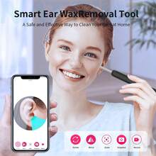 NATFIRE 这款无线智能洁耳器配备摄像头、耳垢清除功能、WiFi连接、6颗LED灯和5个硅胶耳勺，兼容、iPad和安卓设备。它适合居家清洁、旅行、婚礼、派对、生日等场合，也是送给父母和朋友的趣味新年礼物。