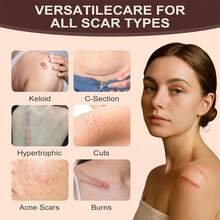 Scar Solution, Silicone Scar Stick, HyaluronicAcid, Centella Asiatica &Vitamin E , Smooths & Moisturizes Skin, Suitable For Face & Body Use - 1件裝 - 查看 4