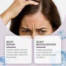 Scalp Revitalizing Repair Serum - Deeply Nourish Repair Damaged Hair Roots Strengthen Hair Quality Prevent Hair Breaking Reduce Roughness Radiate Healthy Glow (15ml) - Serum - 查看 5