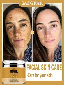 Honey Cream, A Soothing And Moisturizing Cream/Body Butter That Can Be Used For Body And Facial Care, Providing All-Over Hydration.