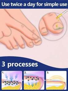 Say Goodbye To Thick Nails, Improve Yellow Nails, Foot Care Tools To Boost Your Confidence. - 1pcs - View 6