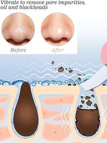 1/3pcs Non-Electric Facial Blackhead Remover Tool, Gentle Pore Cleansing, Textured Surface Design, Suitable For All Seasons - Multicolor - View 2