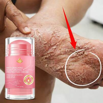 SUMIFANG Crema hidratante y protectora para los pies, que nutre profundamente y sella la humedad, evitando las grietas, mejorando el descamado y la aspereza. La textura es nutritiva pero no pesada ni pegajosa, se absorbe rápidamente después de la aplicación para proporcionar una nutrición duradera para las manos y los pies. El uso regular no afectará a las actividades diarias.