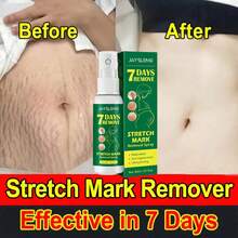 30ml Skin Care Spray Postpartum Abdominal Skin Moisturizing Massage Care Spray - 30 Ml - View 1