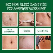 Postpartum Abdominal Skin Moisturizing Massage Care - 30 Ml - View 6