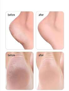 2件装足部刮刀：光滑足底 + 轻松去除老茧 + 男女通用修脚工具 - 彩色 - 查看 8