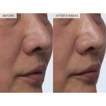 PHA + BHA Face Toner - Korean Skin Care Pore Minimizer & Gentle Facial Exfoliator For Tightening, Hydrating 150ml - 150ml - Xem 6