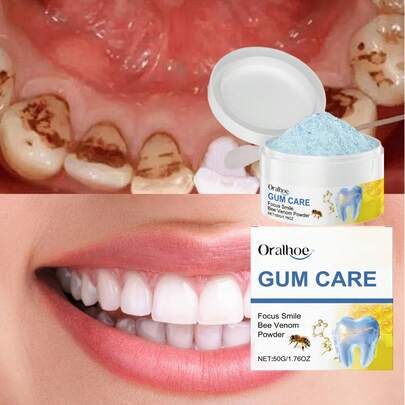 50g Polvo de diente de abeja para limpieza - Ingredientes naturales que cuidan suavemente los dientes, refrescan el aliento y mantienen la boca limpia - Polvo de cuidado oral portátil diario - Suave y no irritante para la boca - Conveniente para viajar