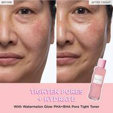 PHA + BHA Face Toner - Korean Skin Care Pore Minimizer & Gentle Facial Exfoliator For Tightening, Hydrating 150ml - 150ml - Xem 4