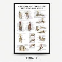 Muscle System Anatomy Poster - Frameless Human Muscle Anatomy Poster, Suitable For Fitness And Exercise Education Sticker
