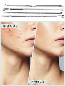 5件套银色祛痘针套装，黑头粉刺去除针，粉刺挤压器，美容针，祛痘夹，黑头镊子，美容工具