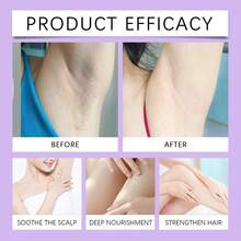Cyperus Rotundus Skin Serum - After Hair Removal Gentle Care Reduces Irritation Moisturizing Refreshing Soothing Relieve Discomfort Improve Skin Smoothness Comfort (60ml) - Serum - 查看 9