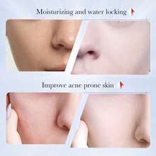 Whitening And Anti-Freckle Cream, Spot Removal, Moisturizing And Whitening Cream For Men And Women - Nhiều màu 1 - Xem 7