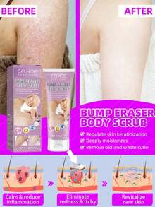 Strawberry Legs Removing Cream For Keratosis Pilaris Skincare Lotion - 1 mặt hàng - Xem 4