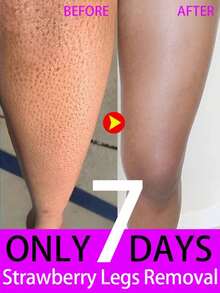 Strawberry Legs Removing Cream For Keratosis Pilaris Skincare Lotion - 1 mặt hàng - Xem 1