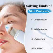 200mAh Ultrasonic Facial Cleansing Brush - USB Rechargeable, Vibrating Blackhead Remover, Scraping Exfoliating Beauty Tool, Economical Skincare Device, Includes 2 Silicone Heads, 4 Modes, Perfect Blackhead Removal Tool - 彩色 - 查看 7