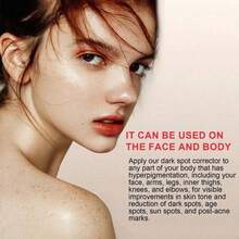 Topicals Faded Brightening And Clearing Serum |   Reduces Discoloration Post-Blemish Marks Scars Spots Contains Kojic Acid Niacinamide Dermatologist-Tested Vegan Cruelty-Free Fl Oz - PINK - View 7